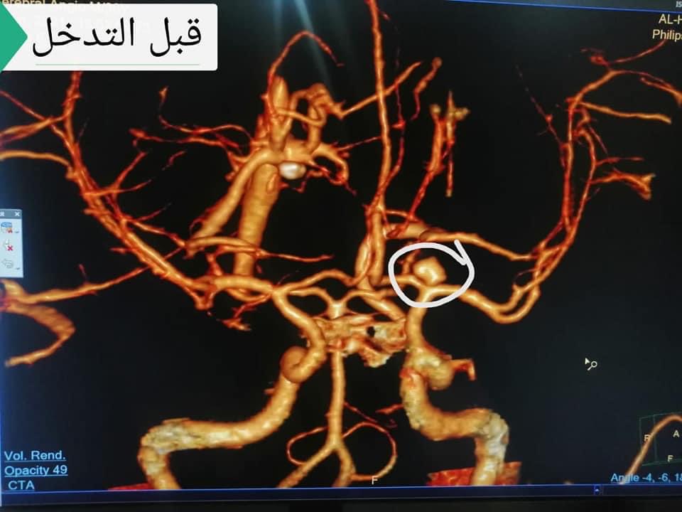 8CFBE8DD-F7D7-4420-821B-9665EC7B96EB