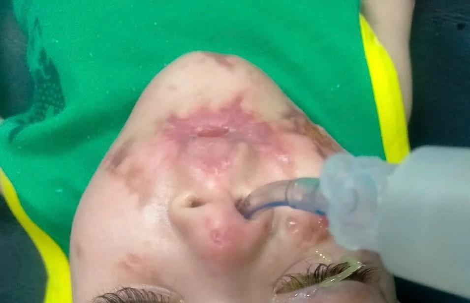 39163-الطفل-امصاب-